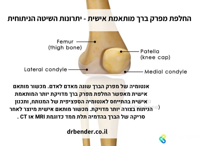החלפת מפרק ברך מותאמת אישית - יתרונות השיטה הניתוחית