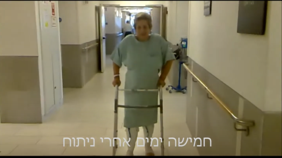 החלפת מפרק ברך, שני מפרקי הברכיים בניתוח אחד