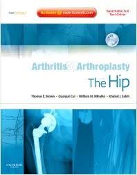 עטיפת הספר Arthritis & Arthroplasty: The Hip, ספר מקצועי בתחום ניתוחי מפרק הירך עם הדמיית שתל ירך ועיצוב רפואי בגווני כחול